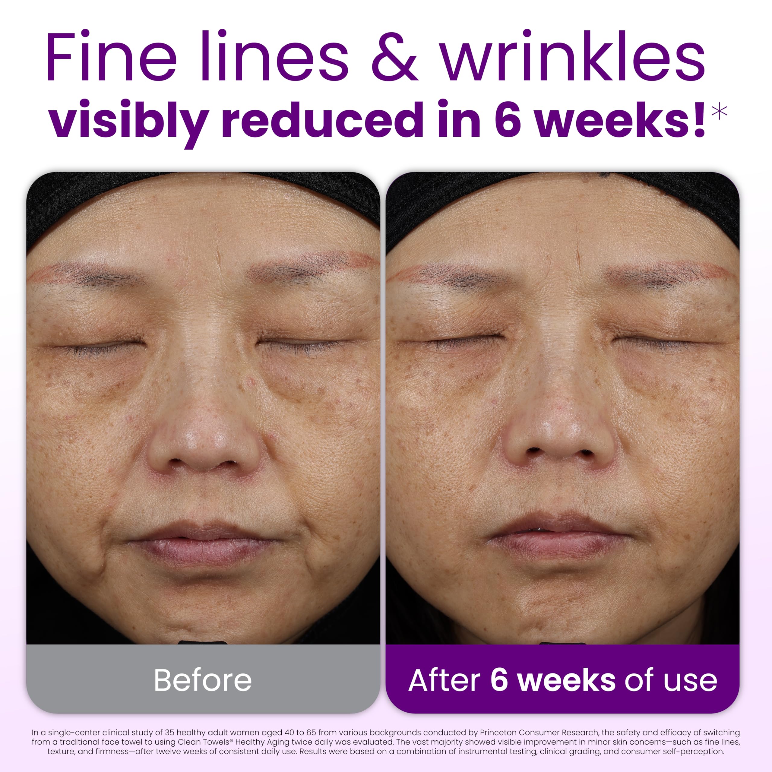 Best CLEAN SKIN CLUB Healthy Aging Clean Towels® XL, Reduces Fine Lines, Wrinkles & Texture, Disposable XL Face Wipes - 1 Pack (50 Count)